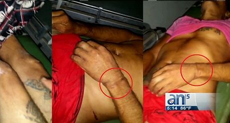 Nuevas fotos del cubano que murió tras golpiza policial cubana