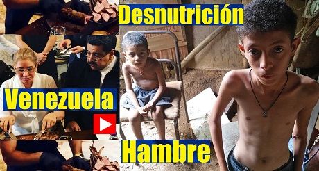Venezuela hambre y desnutricion