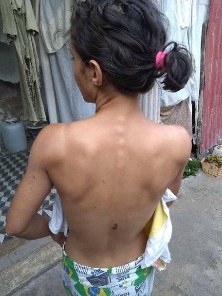 Golpiza de la dictadura a jimaguas Miranda Leyva 2