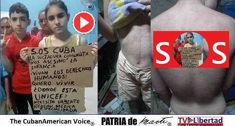 Nina Opositora Necesita Atencion Medica URGENTE