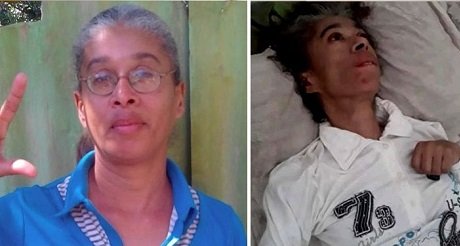 Opositora Jacqueline Borrego muere por negligencia castrista
